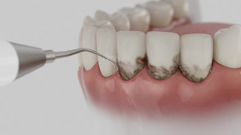 Trusted Root Canal Treatment service in Granite City, IL - Dentist Open Now